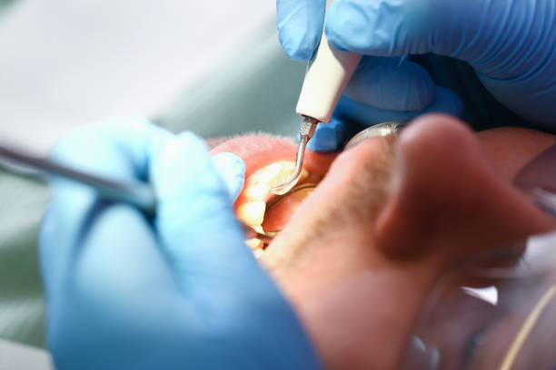 Best Emergency TMJ Treatment in Chama, NM